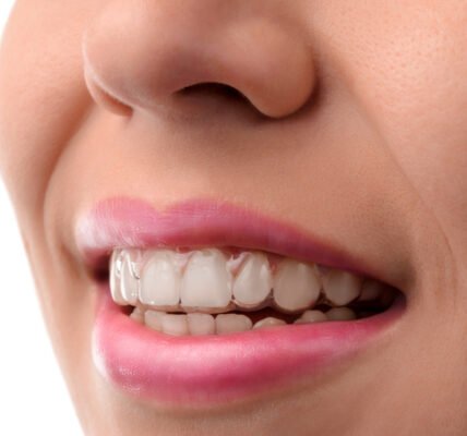 Invisalign Aberdeen